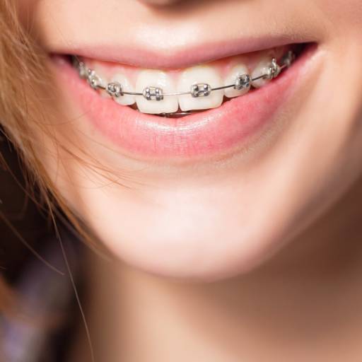 Comprar o produto de Odontologia: Ortodontia em Odontologia pela empresa Clinica Moreno & Joaquim em Botucatu, SP por Solutudo