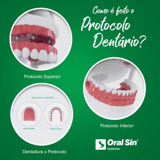 Comprar o produto de Prontocolo Dentário em Bauru em Odontologia pela empresa Oral Sin Implantes em Bauru, SP por Solutudo