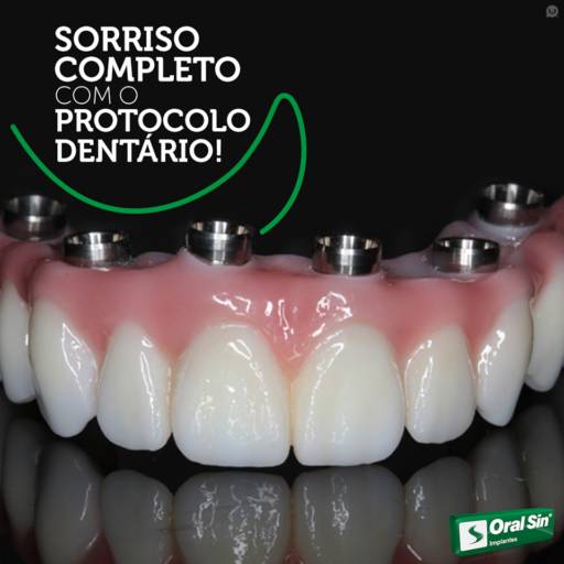 Comprar o produto de Prontocolo Dentário em Bauru em Odontologia pela empresa Oral Sin Implantes em Bauru, SP por Solutudo