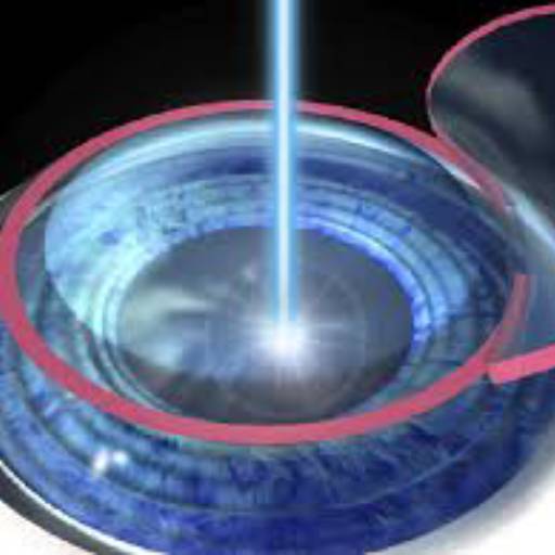 cirurgia refrativa - Personalizada a laser por Clinica de Olhos Prime