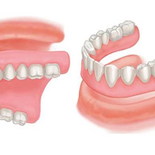 Prótese Total em Bauru por Dr. João Marzola - Odontologia Marzola