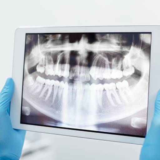 Raio X Dentário  em Americana, SP por Dra. Ana Barros - Odontologia e Estética 
