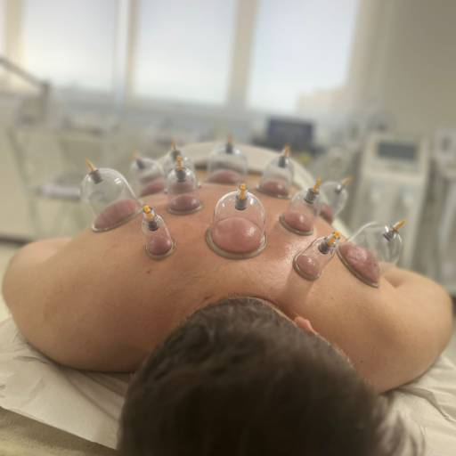 Ventosaterapia (Terapia com Ventosas) em Bauru por Simone D'Avila Esteticista 