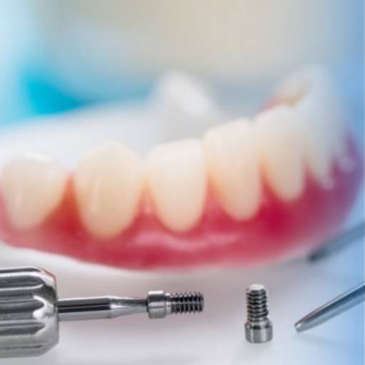Prótese Overdenture