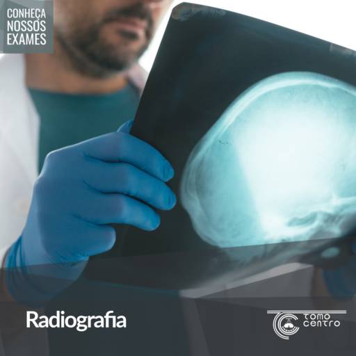 Comprar o produto de Radiografia  em Radiologia e Diagnóstico por Imagem pela empresa Tomocentro em Botucatu, SP por Solutudo