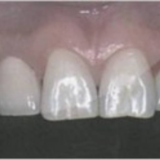 Comprar o produto de Implante Dentário em Outros Serviços pela empresa  Dr. Dante Cavecci Júnior - CRO 74.097 em Avaré, SP por Solutudo