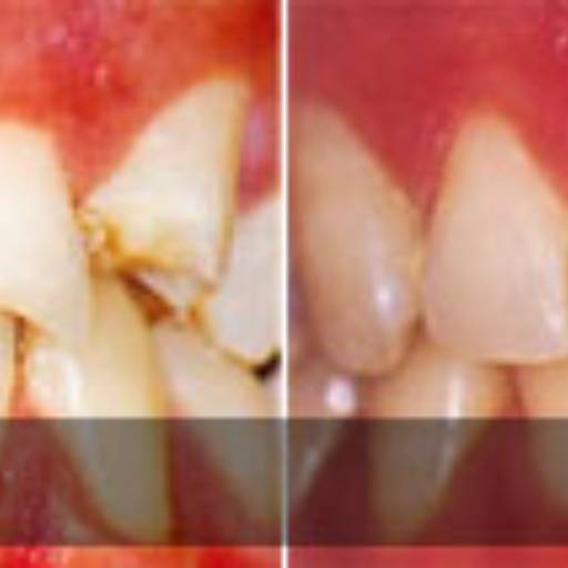 Aparelho nos Dentes por  Dr. Dante Cavecci Júnior - CRO 74.097