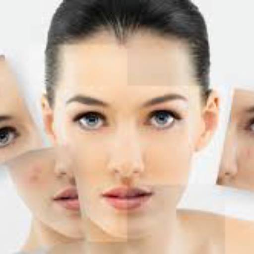 TRATAMENTO PARA ACNE