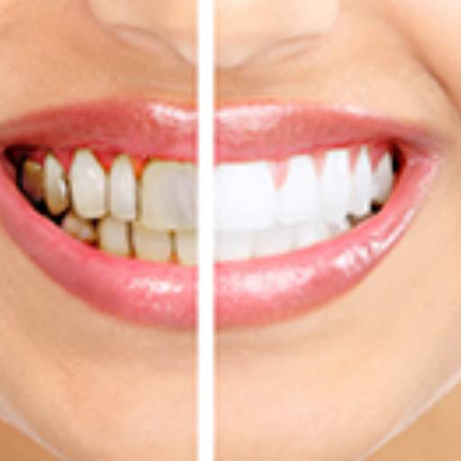 Dentística (restauração) por Odontologia Orlandi