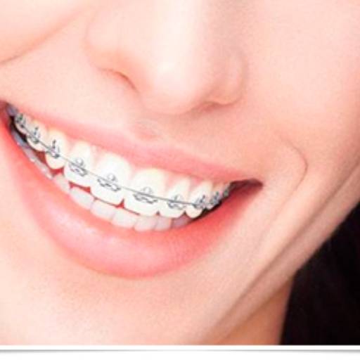 Ortodontia (aparelho) por Odontologia Orlandi