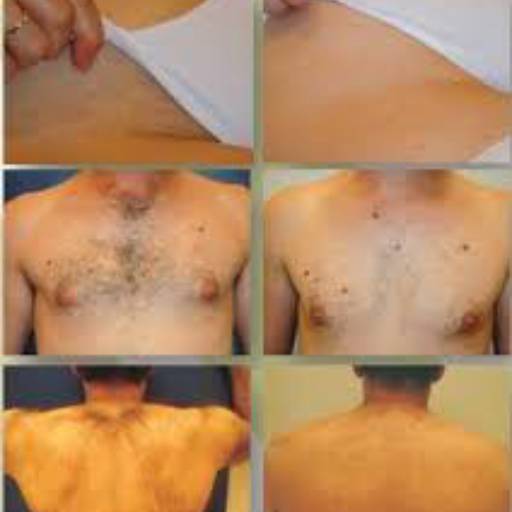 Depilação Masculina por Preta Depilações