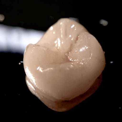 Coroa em Cerâmica Pura