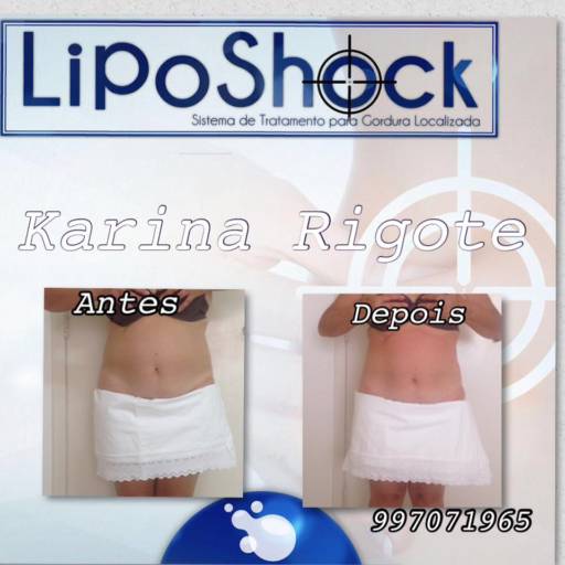 Liposhock em Avaré