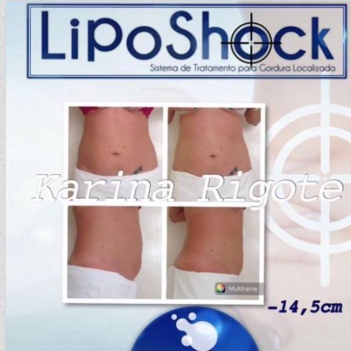 Liposhok em Avaré