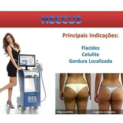 Heccus por Fernanda Lima