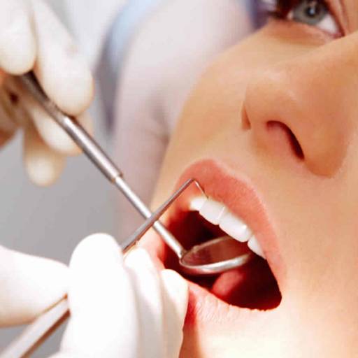 Extração Simples por Consultório Odontológico Lilia El Saman