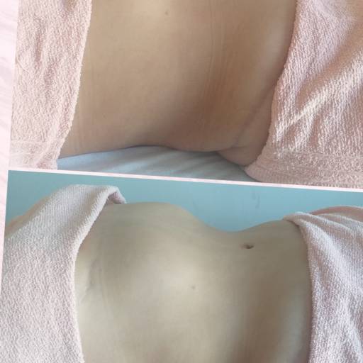 Método Nazaré Santos 