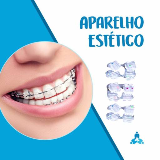 Comprar o produto de Aparelho Estético em Odontologia pela empresa Art Dentaire - Harmonizando Sorrisos em Itapetininga, SP por Solutudo