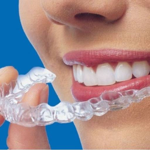 Comprar o produto de  invisalign em Odontologia pela empresa CDA Sorriso (CROSP 1555) em Itapetininga, SP por Solutudo