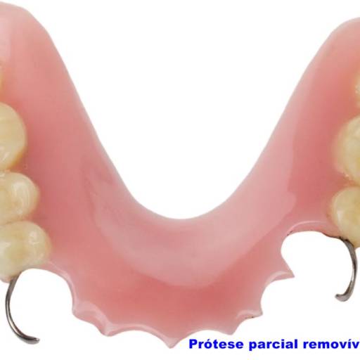 Prótese Dentária por Dra Gabriela Antunes Silva CRO-SP 88092