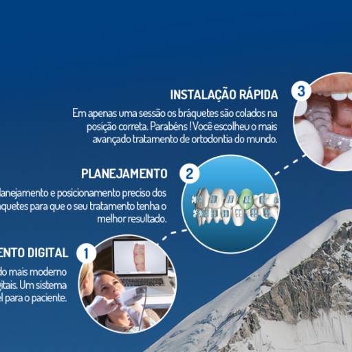 Everest por Odontoclinic Jundiaí Anhangabaú