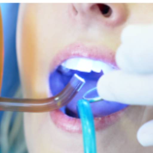 Clareamento a Laser por Odontoclinic Jundiaí Anhangabaú