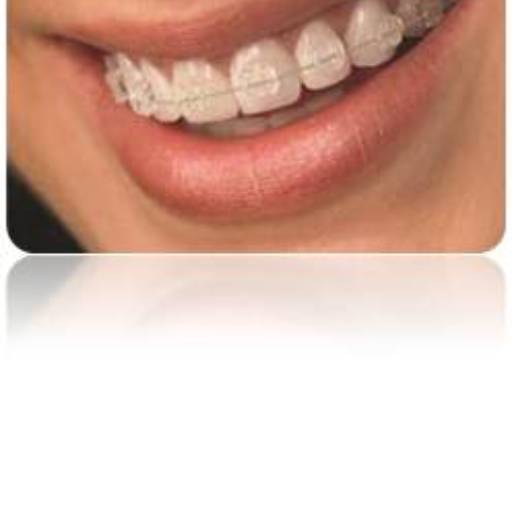 Ortodontia por Sartori Odontologia CR0-SP 19464 - RT: Patrícia Sartori CR0 106940