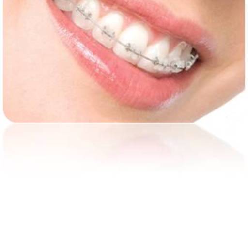 Ortodontia por Sartori Odontologia CR0-SP 19464 - RT: Patrícia Sartori CR0 106940