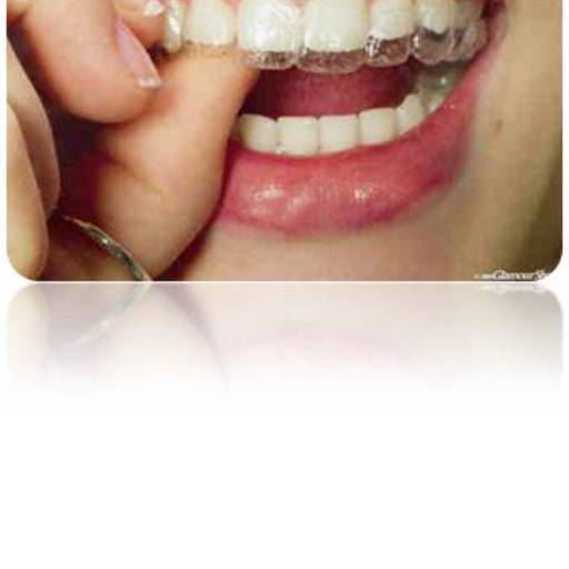 Ortodontia por Sartori Odontologia CR0-SP 19464 - RT: Patrícia Sartori CR0 106940