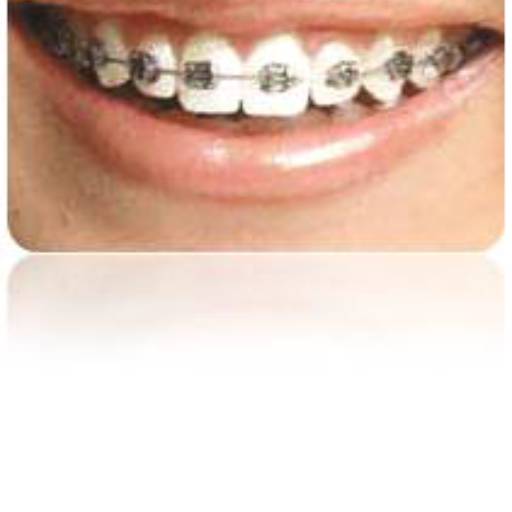 Ortodontia por Sartori Odontologia CR0-SP 19464 - RT: Patrícia Sartori CR0 106940