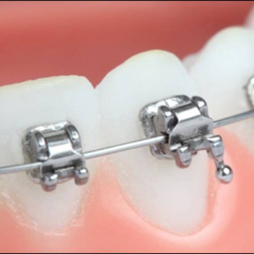 Aparelhos Autoligados por Sartori Odontologia CR0-SP 19464 - RT: Patrícia Sartori CR0 106940