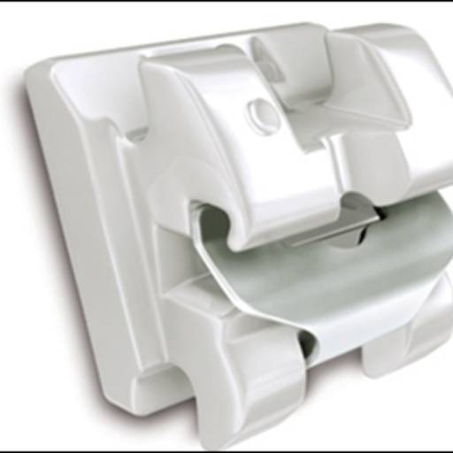 Aparelhos Fixos de Safira por Sartori Odontologia CR0-SP 19464 - RT: Patrícia Sartori CR0 106940