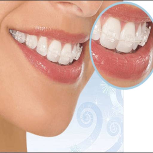 Aparelhos Fixos de Porcelana