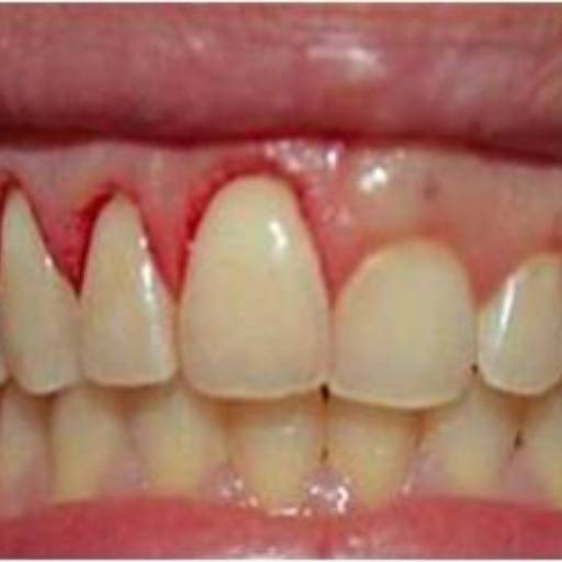 Periodontia por Sartori Odontologia CR0-SP 19464 - RT: Patrícia Sartori CR0 106940