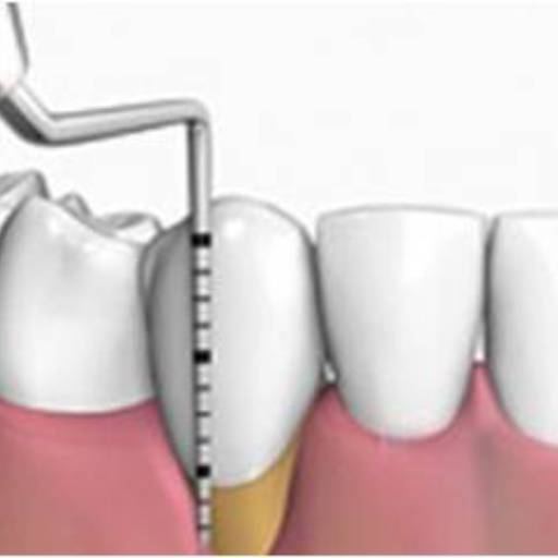 Periodontia por Sartori Odontologia CR0-SP 19464 - RT: Patrícia Sartori CR0 106940
