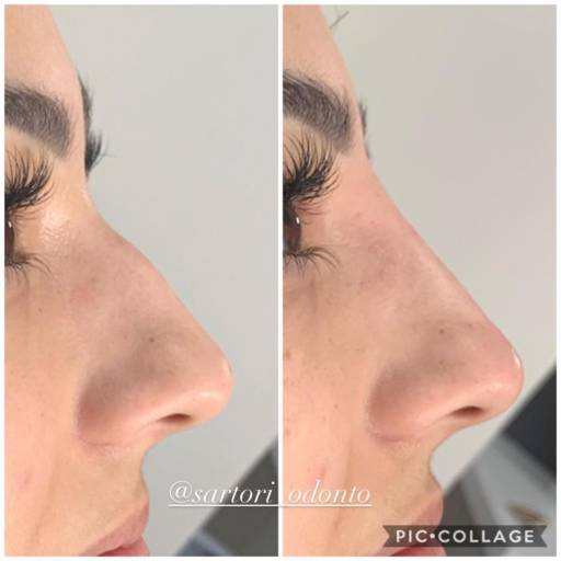 Estética Facial por Sartori Odontologia CR0-SP 19464 - RT: Patrícia Sartori CR0 106940