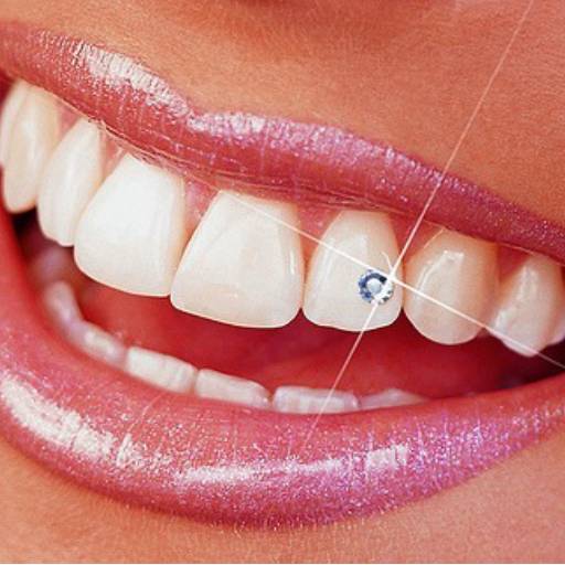 Piercing dental por Dra. Elisabete Thomaz