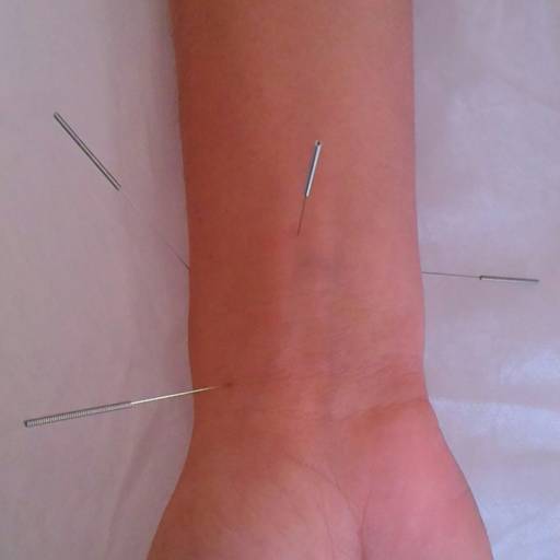 ACUPUNTURA por Livia Cruz Acupuntura