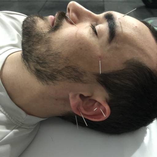 ACUPUNTURA por Livia Cruz Acupuntura