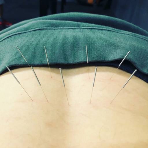 ACUPUNTURA por Livia Cruz Acupuntura