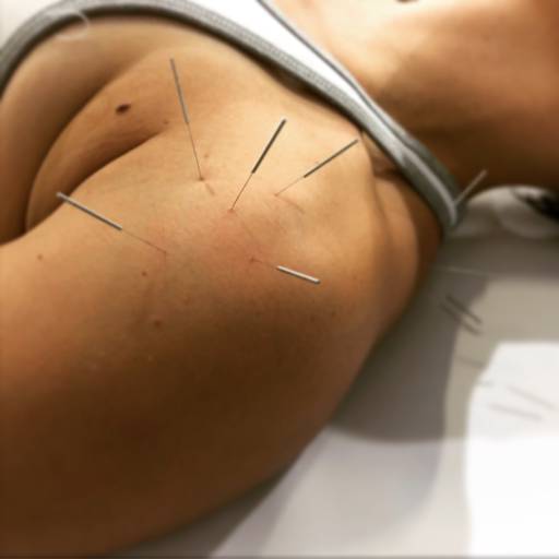 ACUPUNTURA por Livia Cruz Acupuntura