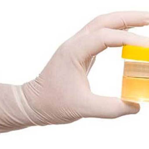 Exame de urina por Laboratório Sabin - Super Muffato