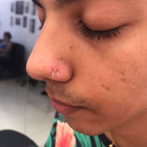 Perfuração aba Nasal