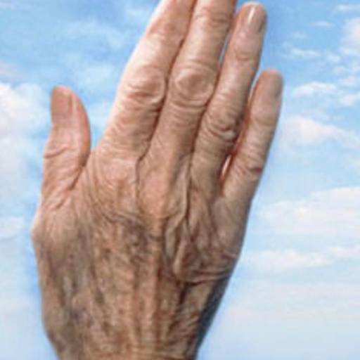 Rejuvenescimento de Mãos