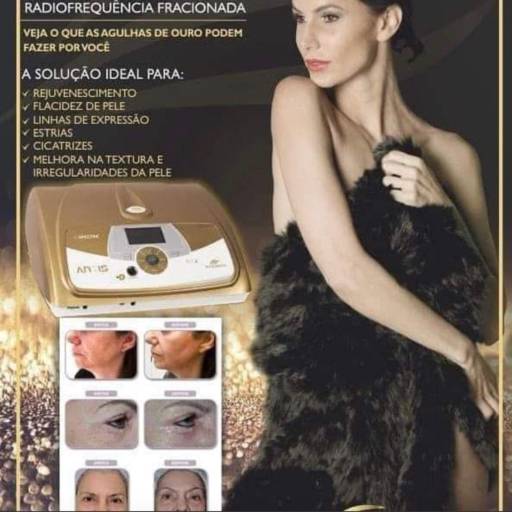 Radiofrequência fracionada