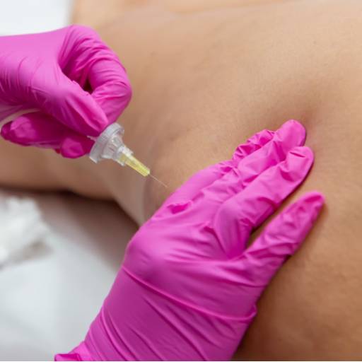 Criolipólise por Sbelt Center - Centro Especializado em Emagrecimento