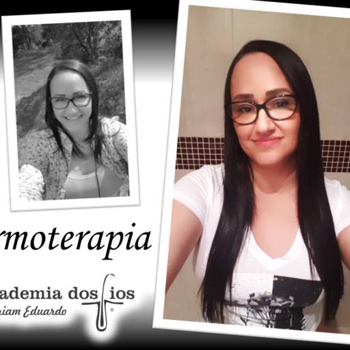 Cronograma de tricoterapia para química - Termoterapia