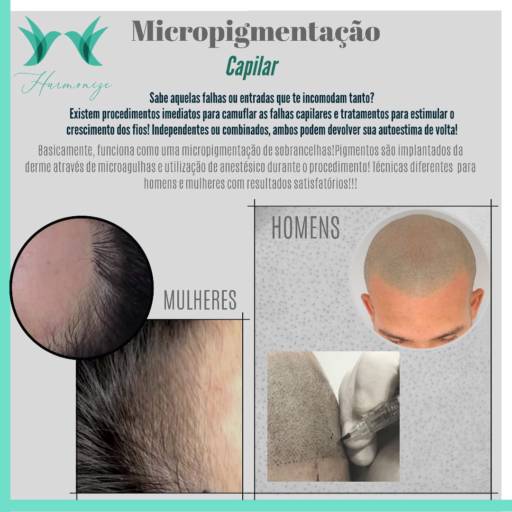 Micropigmentação Capilar Feminina por Instituto Harmonize