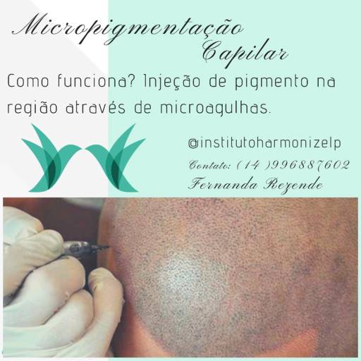 Micropigmentação Capilar Masculina por Instituto Harmonize