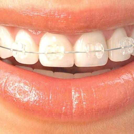 Comprar o produto de Ortodontia em Saúde pela empresa Dra Juliana Assis | Ortodontia em Aracaju, SE por Solutudo
